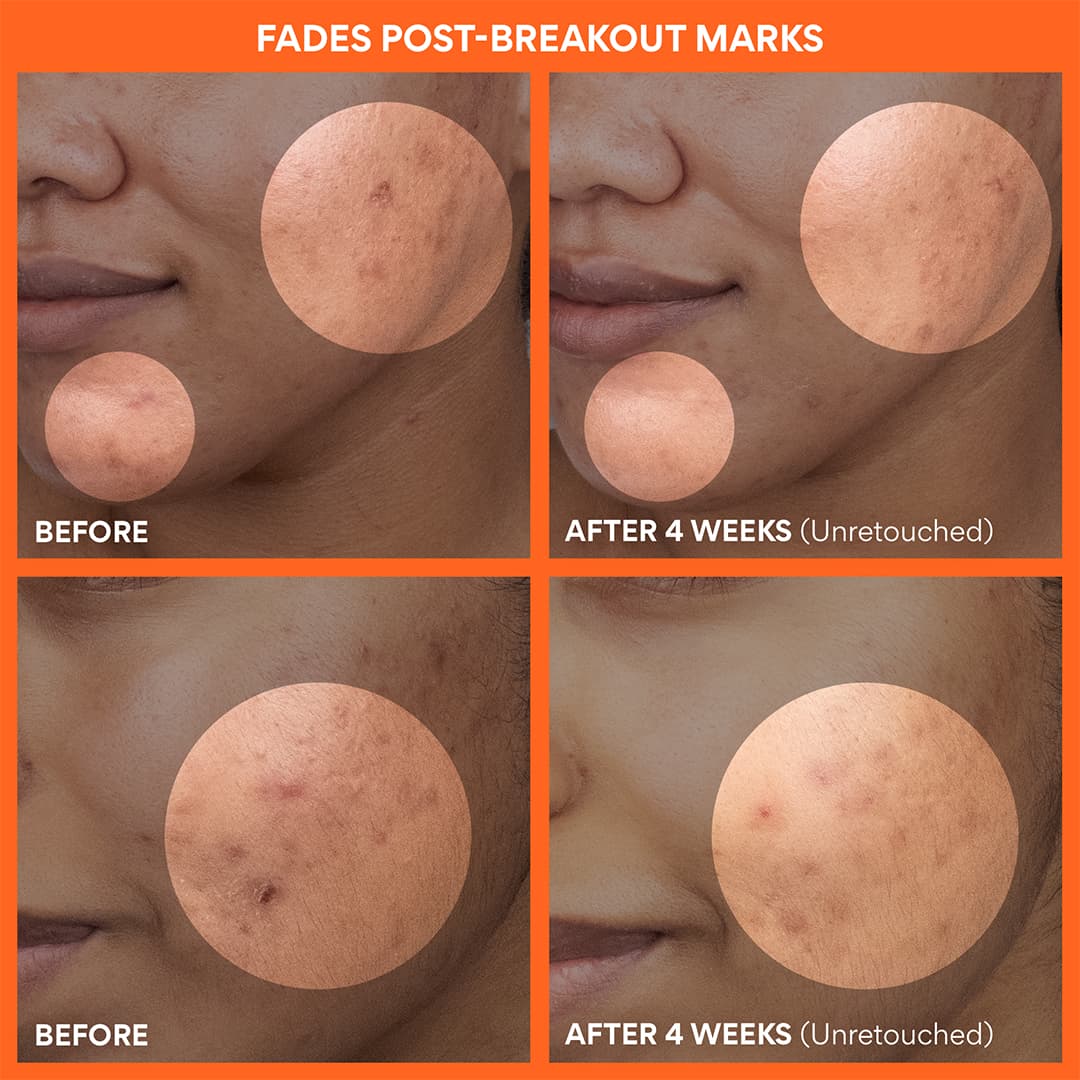 Green Tea Enzyme Vitamin C Brightening Toner Pads